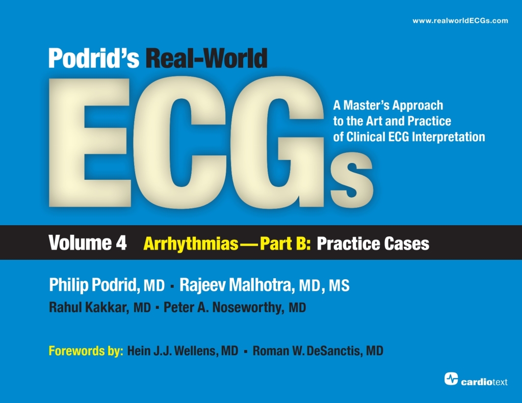 Podrid's Real-World ECGs: Volume 4B, Arrhythmias [Practice Cases] 1st Edition â€“ PDF/EPUB Version Downloadable